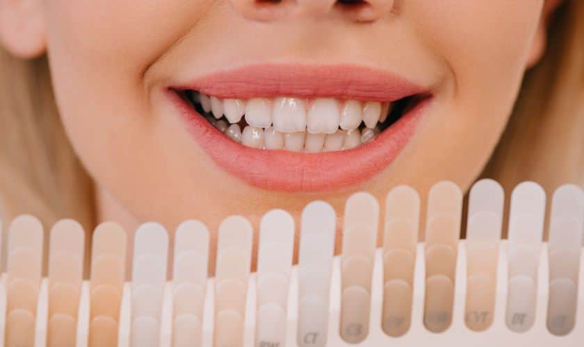 Person displaying bright white smile next to tooth shade comparison guide