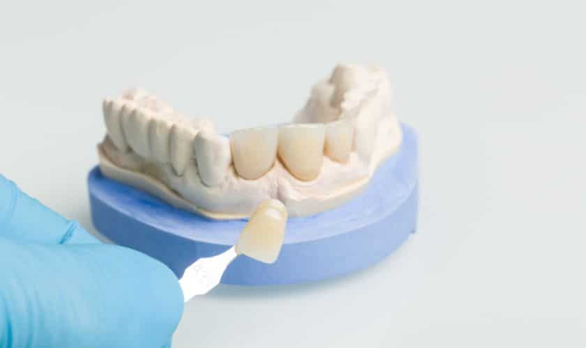 Cosmetic Dentistry norton