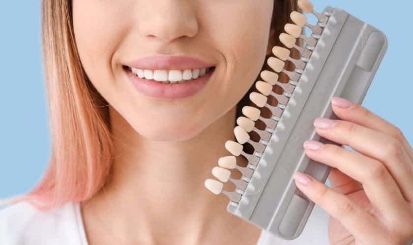 Dental Veneers Gate City