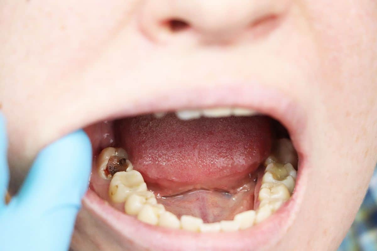Smell Cavities