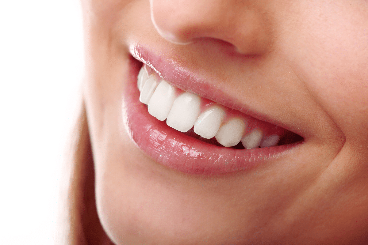 Key Benefits of Lumineers for Your Smile