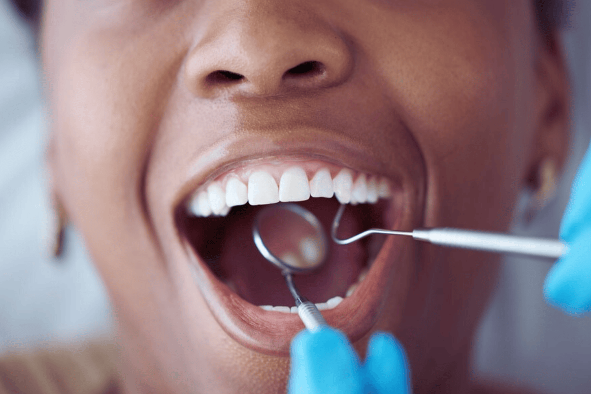 Omega-3 Foods to Promote Healthy Gums