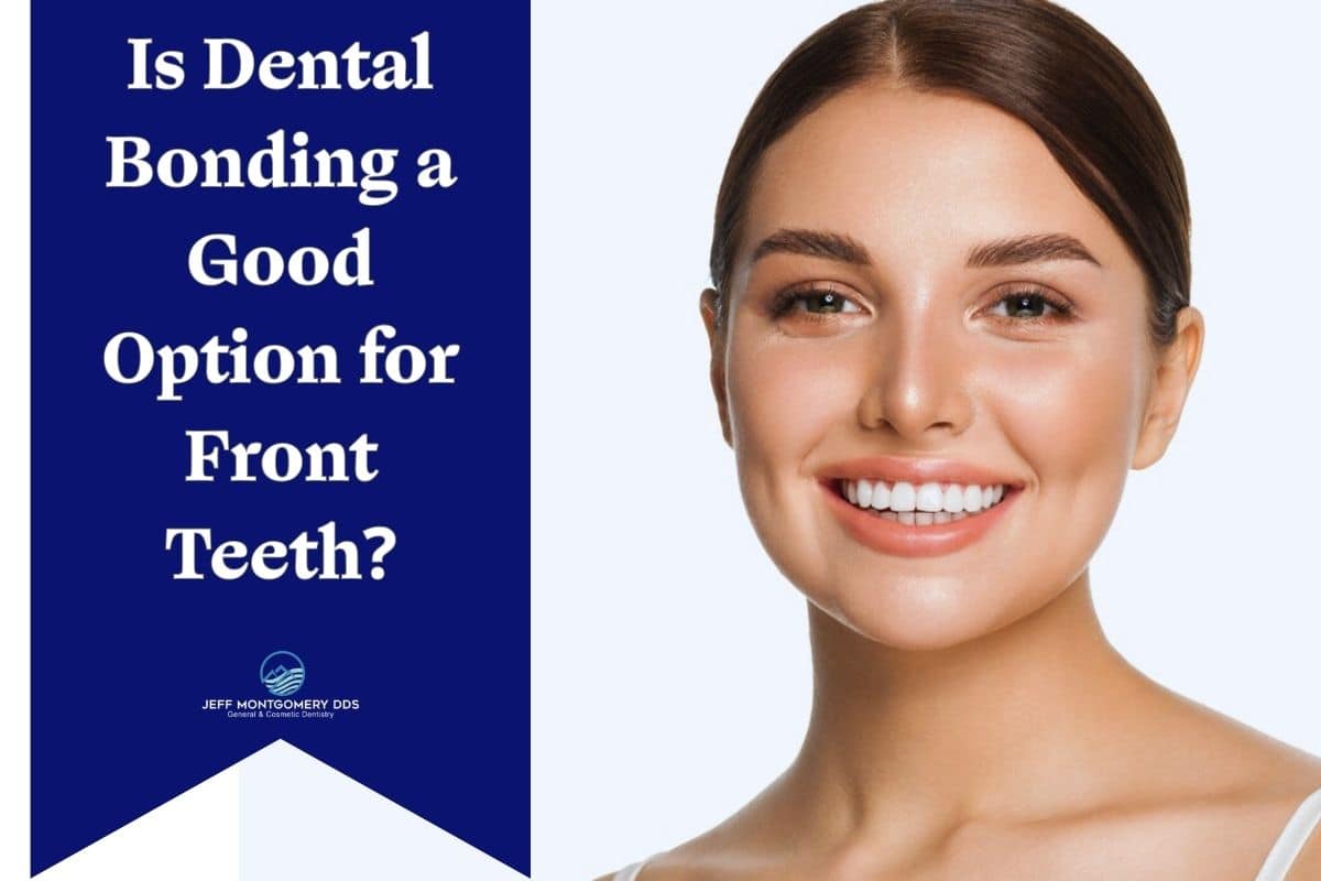 is dental bonding right for front teeth?