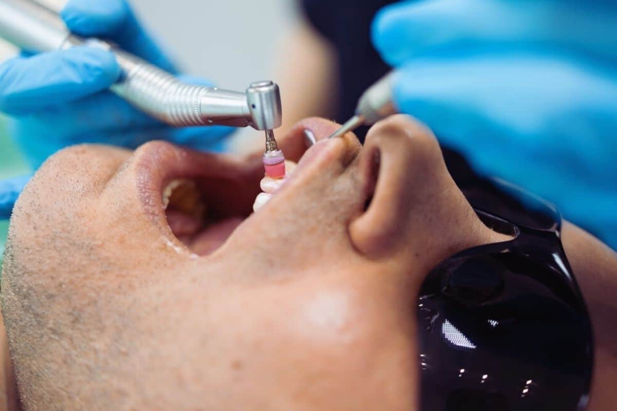How Often Do You Really Need a Dental Cleaning?