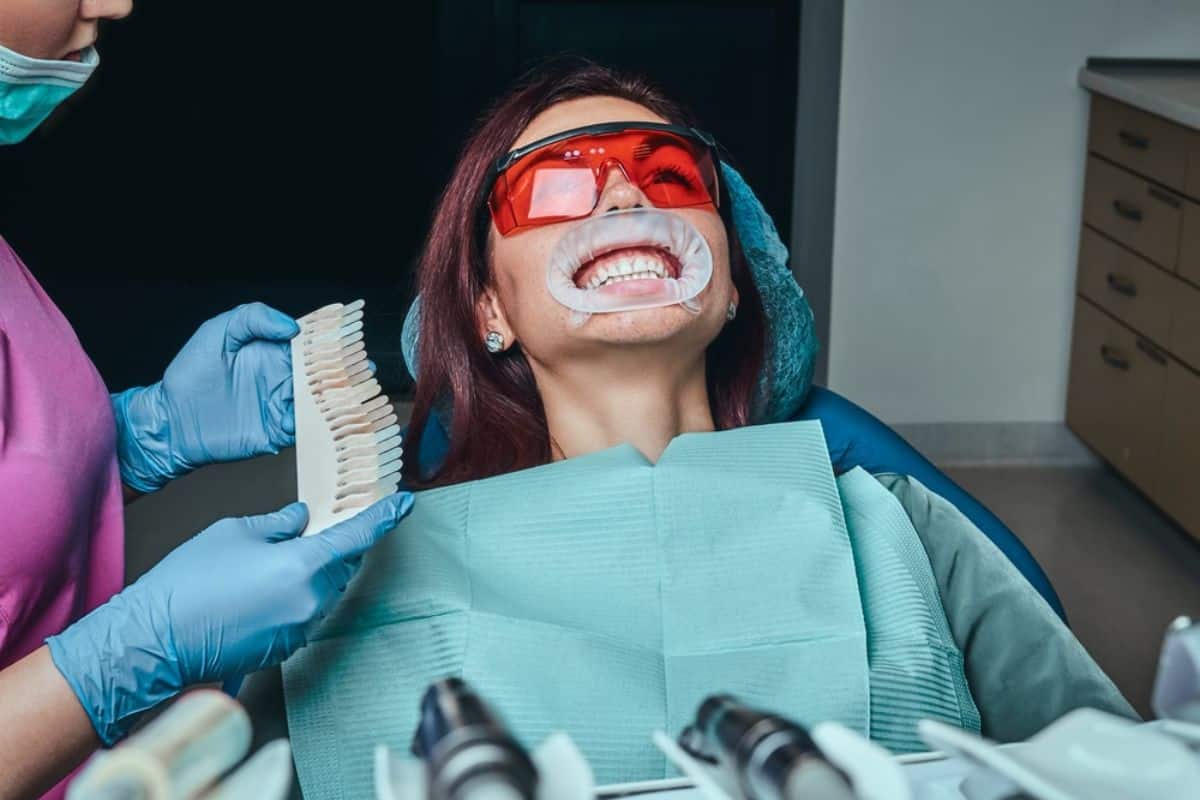 Benefits of Professional Teeth Whitening
