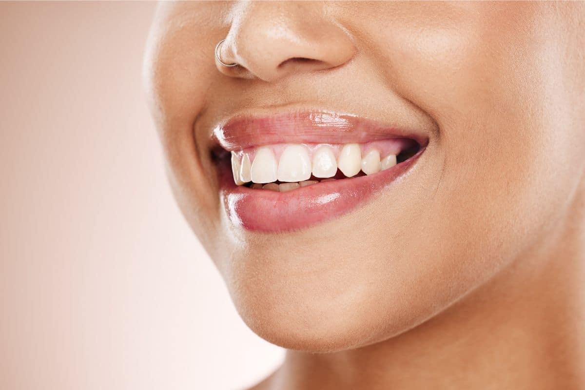How to Maintain Your Teeth Whitening Results