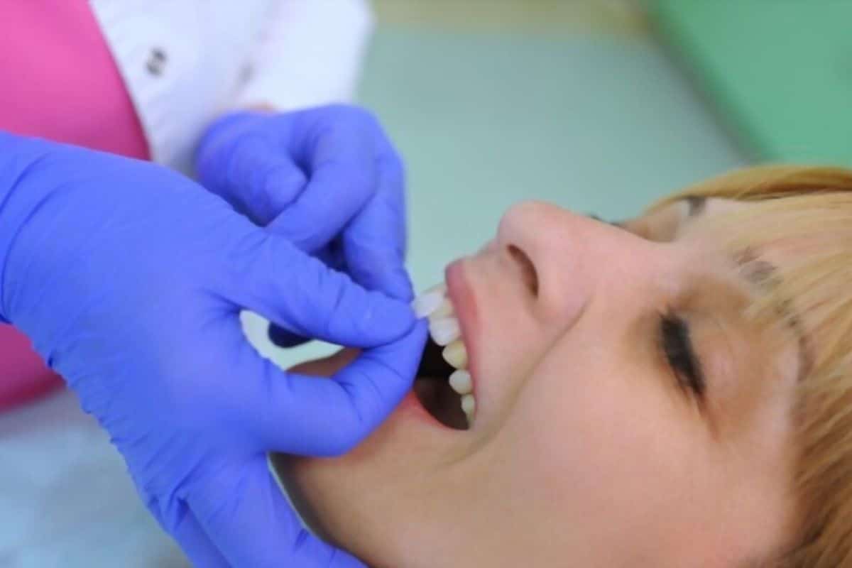 Can Veneers Fix Gaps in Teeth