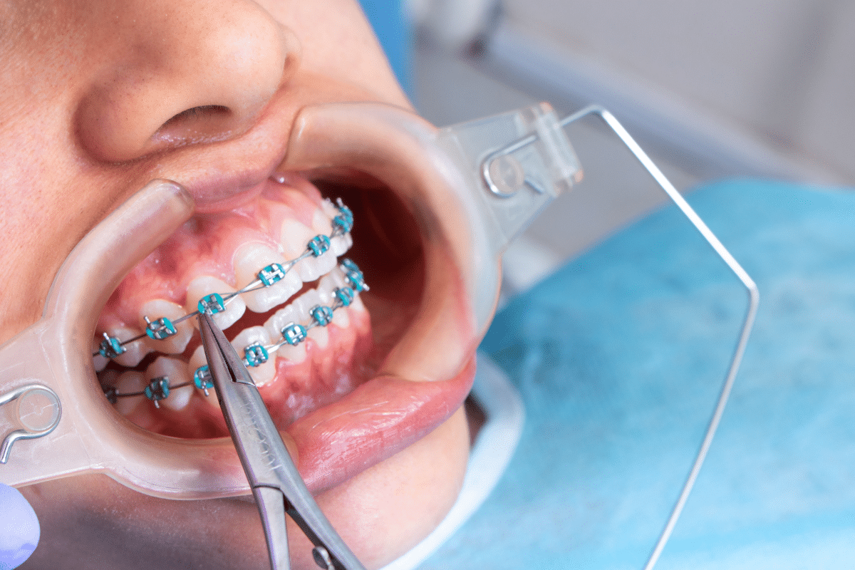 Cosmetic Dentistry